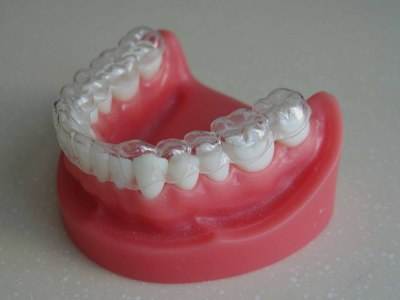 牙齿矫正多久会有效果？