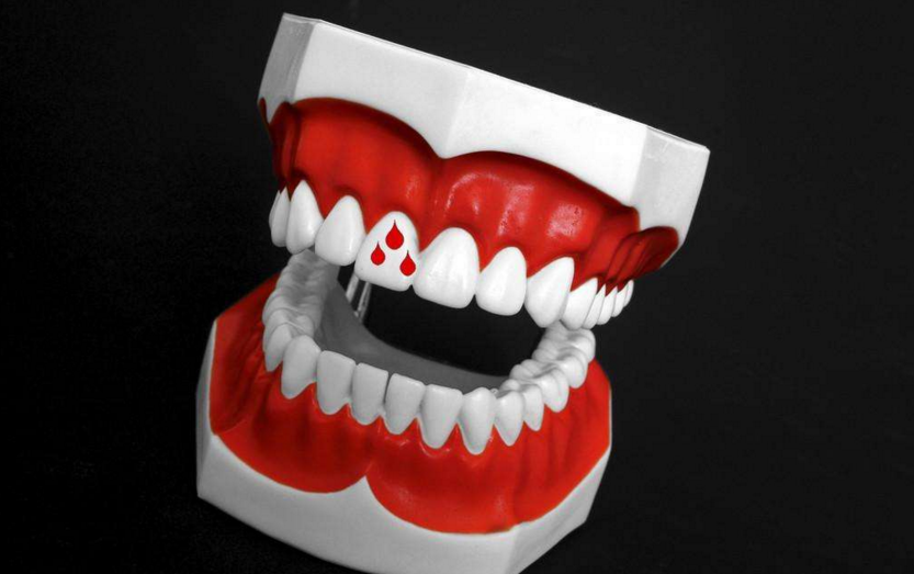 牙龈出血是什么原因？